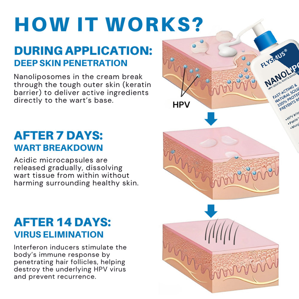 Flysmus® NanoLipo HPV Genital Warts Eraser Cream