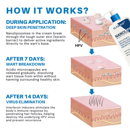 Flysmus® NanoLipo HPV Genital Warts Eraser Cream