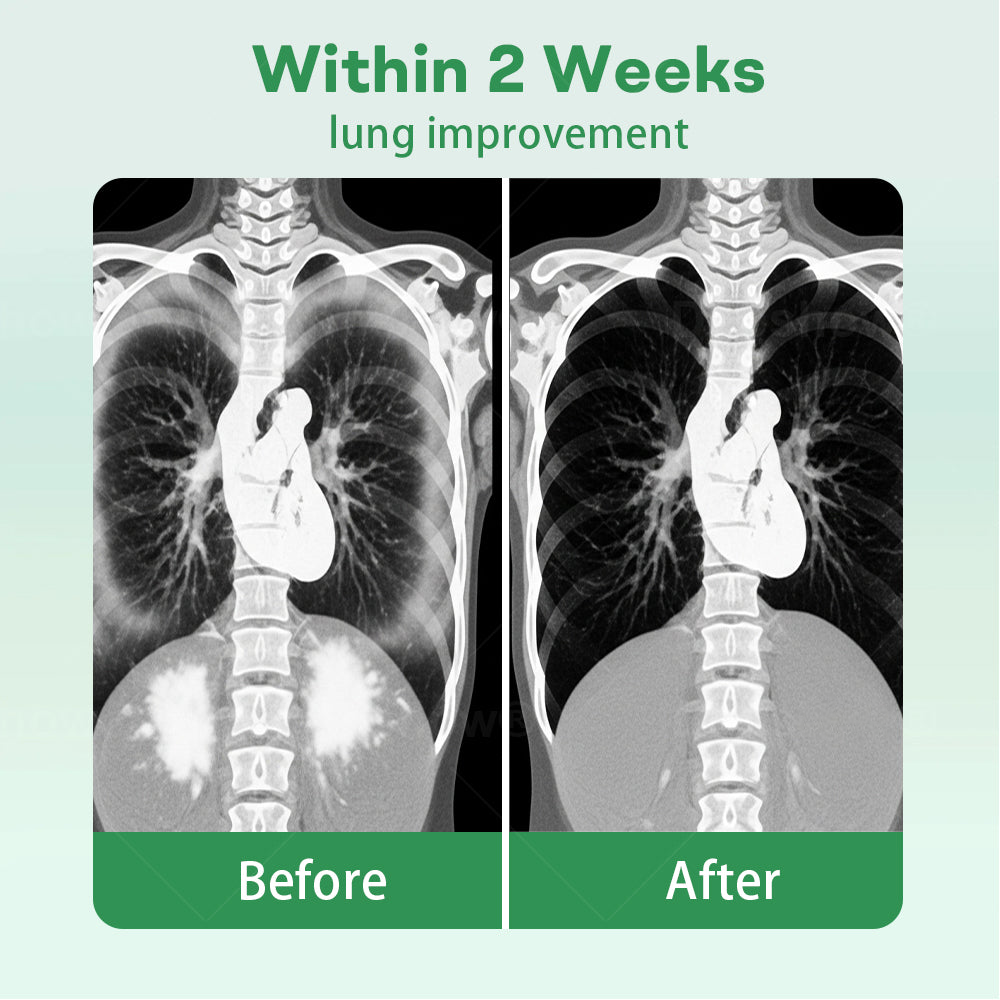 ✅Official Store| 𝙁𝙡𝙮𝙨𝙢𝙪𝙨® 𝐇𝐞𝐫𝐛𝐚𝐥 𝐋𝐮𝐧𝐠 𝐂𝐥𝐞𝐚𝐧𝐬𝐢𝐧𝐠 𝐈𝐧𝐡𝐚𝐢𝐞𝐫(🫁Cough, wheezing, shortness of breath, sputum, stuffy nose, bronchitis, bronchitis, allergy symptoms, lung discomfort💝)