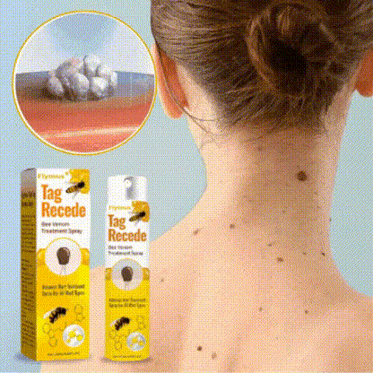 Flysmus® Vaporisateur | Élimine 98 % des acrochordons et des grains de beauté en seulement 7 jours !