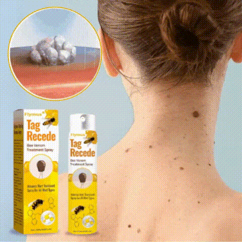 Flysmus® Vaporisateur | Élimine 98 % des acrochordons et des grains de beauté en seulement 7 jours !