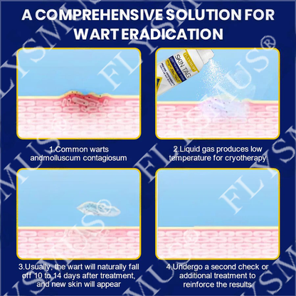 🇨🇦FLYSMUS® SKIN TAG CRYO TREATMENT SPRAY ACE