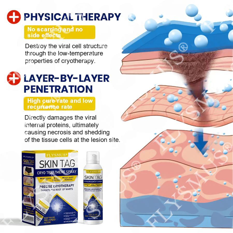 🇨🇦FLYSMUS® SKIN TAG CRYO TREATMENT SPRAY ACE