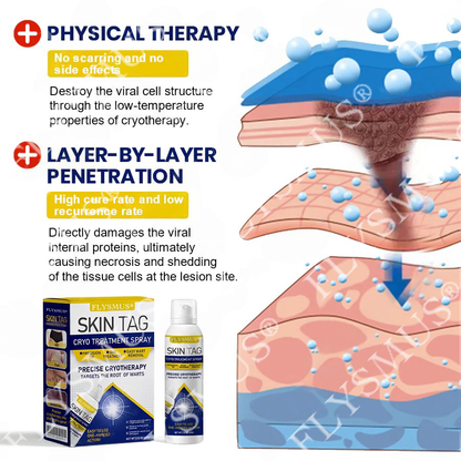 🇨🇦FLYSMUS® SKIN TAG CRYO TREATMENT SPRAY ACE