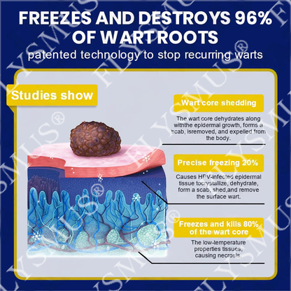 🇨🇦FLYSMUS® SKIN TAG CRYO TREATMENT SPRAY ACE